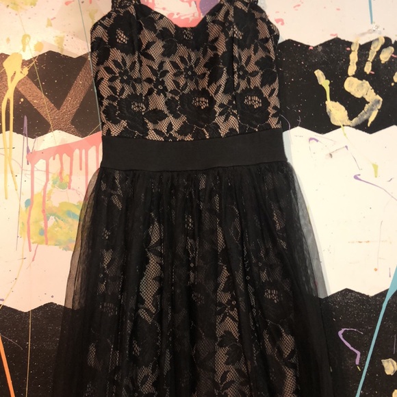 Rue21 Dresses & Skirts - Black Lace Dress
